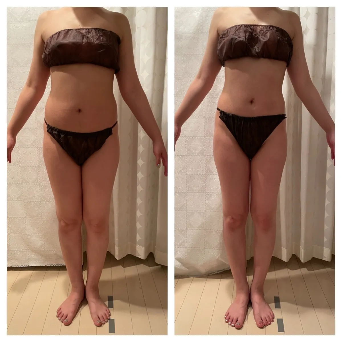 セルゼロ2痩身8回